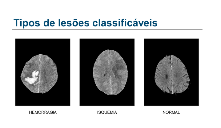 ../assets/img/laboratorios/lais/SDAC-AVC/LAIS3.png